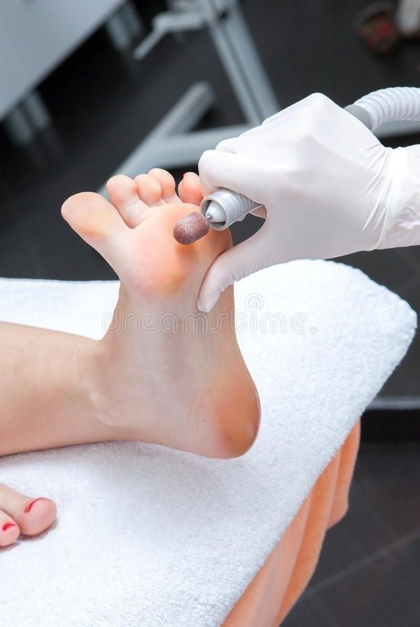 Pedicure Curativo